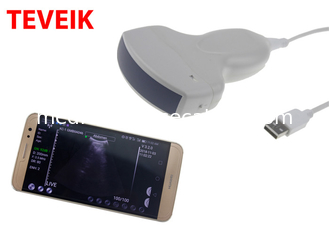 Macchina portatile di doppler di ultrasuono di Wifi della sonda senza fili medica di ultrasuono di Teveik