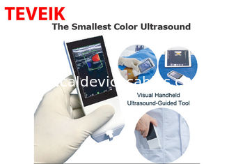 Sonda senza fili portatile di ultrasuono di Android di Wifi della macchina medica di ultrasuono lineare