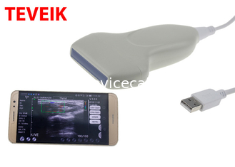 Sonda senza fili di ultrasuono dello Smart Phone, macchina lineare di ultrasuono di USB Protable
