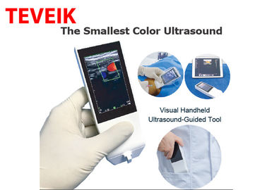 Sonda senza fili portatile di ultrasuono di Android di Wifi della macchina medica di ultrasuono lineare