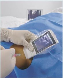 Sonda senza fili portatile di ultrasuono di Android di Wifi della macchina medica di ultrasuono lineare