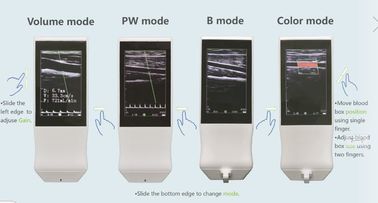 Sonda senza fili portatile di ultrasuono di Android di Wifi della macchina medica di ultrasuono lineare