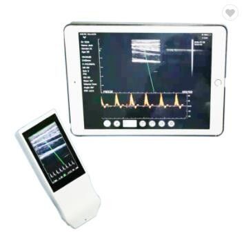Sonda senza fili portatile di ultrasuono di Android di Wifi della macchina medica di ultrasuono lineare