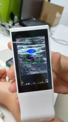 Sonda senza fili portatile di ultrasuono di Android di Wifi della macchina medica di ultrasuono lineare