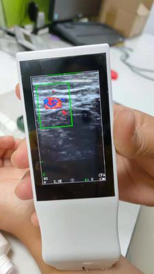 Sonda senza fili portatile di ultrasuono di Android di Wifi della macchina medica di ultrasuono lineare