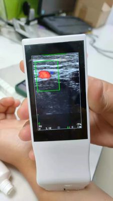 Sonda senza fili portatile di ultrasuono di Android di Wifi della macchina medica di ultrasuono lineare